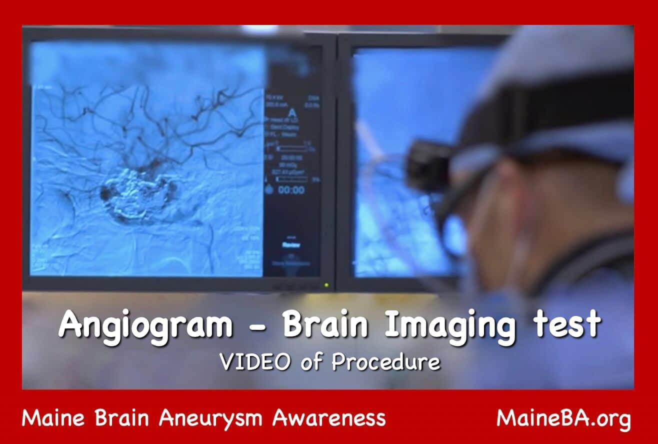 Neuro tech reviewing images from a cerebral angiogram